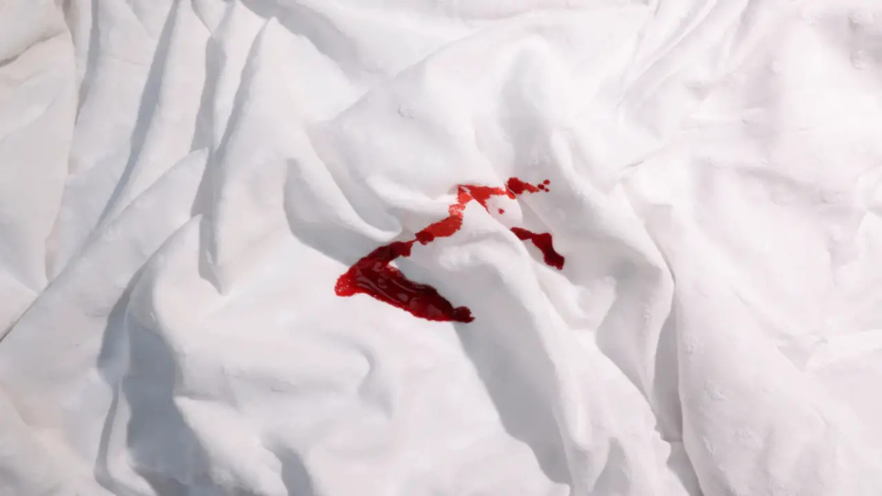 Does Hydrogen Peroxide Really Work On Blood Stains