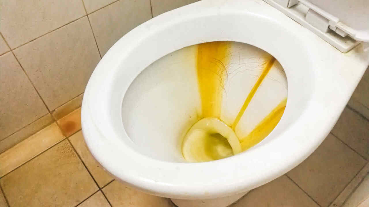 How To Remove Stains From Toilet Seat 8 Effective Ways