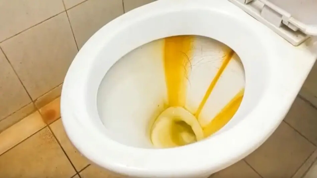 What Causes Yellow Stains On Toilet Seat & How To Clean- You Should Know